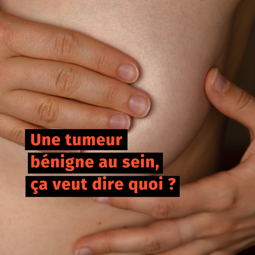 Une tumeur bénigne au sein, ça veut dire quoi ?