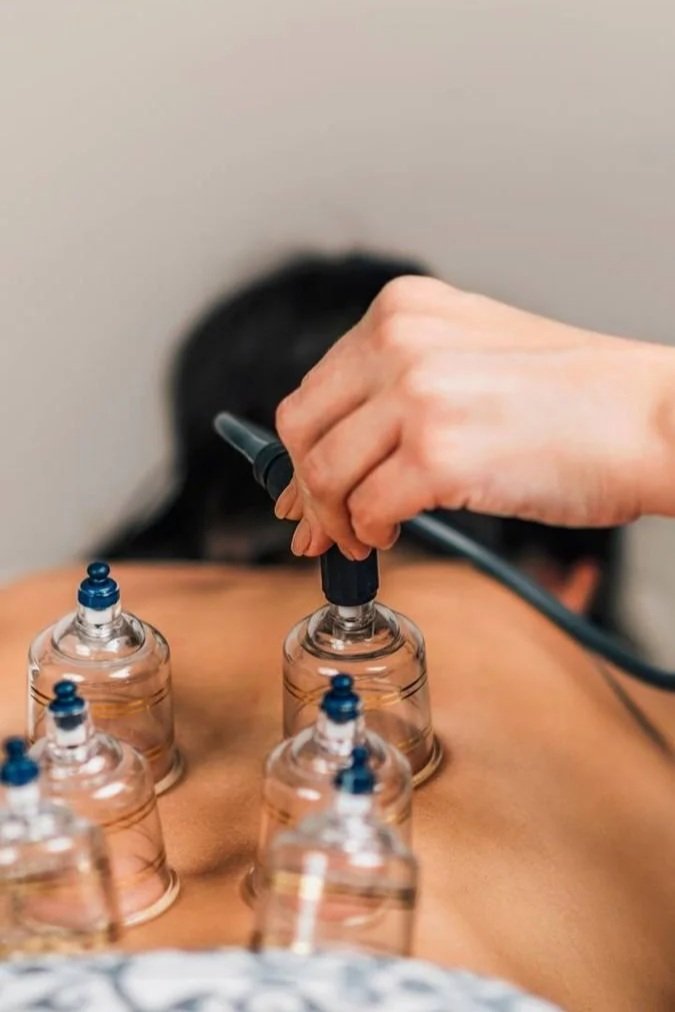 Person receiving cupping therapy with glass cups on their back.