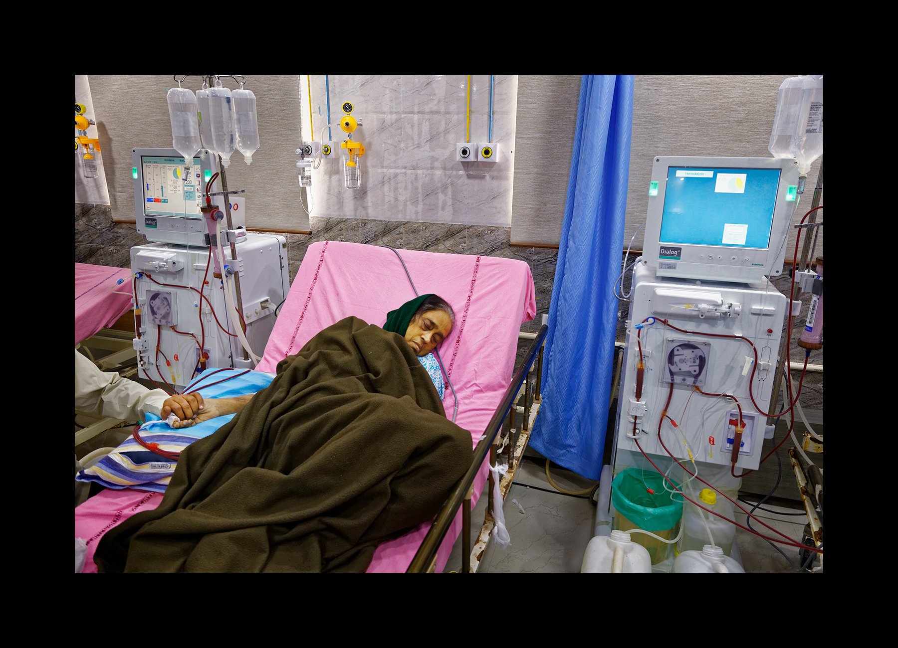  A patient with CKDnT receives treatment in the dialysis unit of the Narayana Medical College in Nellore, India on Jan. 13, 2016. 