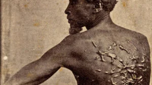 whipping-scars-american-slave-gordon-910x512-300x169.jpg