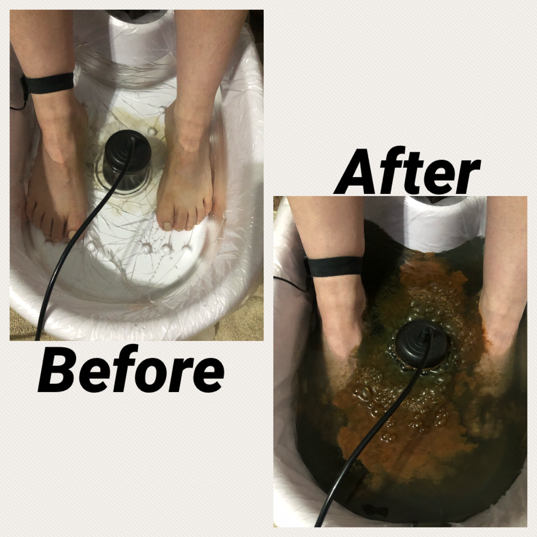 foot detox pic.PNG