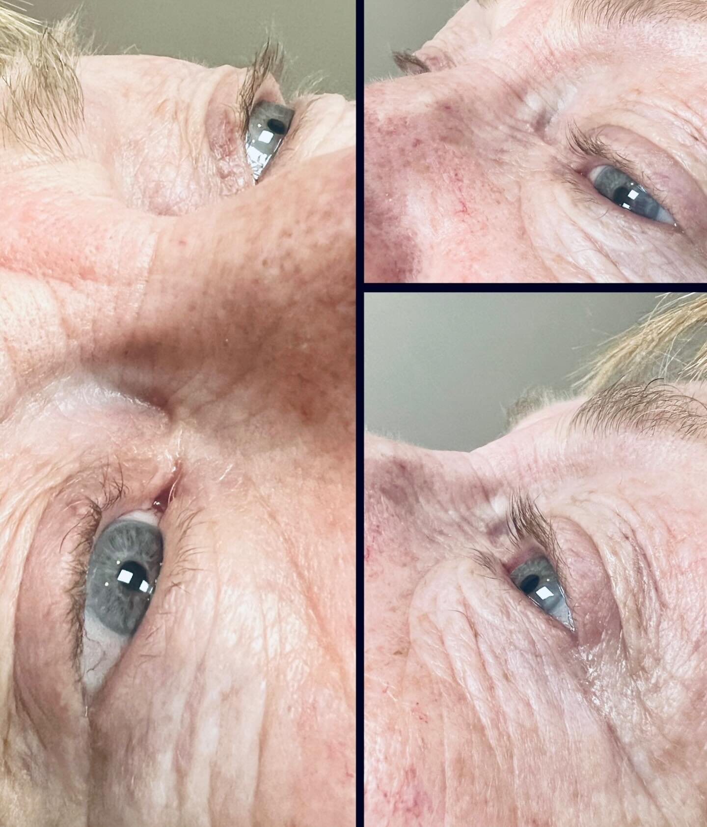 Dramatic results in little time.. beautiful natural lashes SWIPE BEFORE &amp; AFTER 🩵 #lashlift #lashlifting #lashliftandtint #lashlifts #eyelashlift #eyelashlifting #eyelashliftandtint #eyelashlifts 🩵