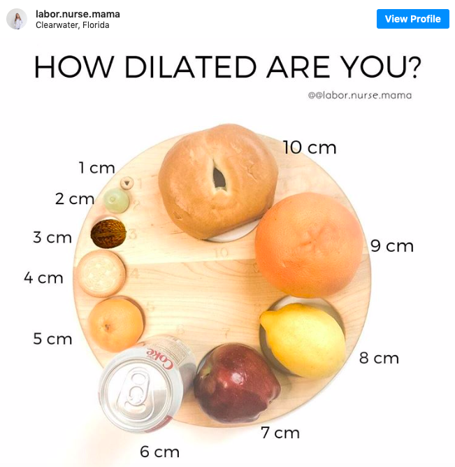 Bishop Scores And What They Tell You About Your Cervix Aila Birth Village Certified Boston Birth Doula Postpartum Doula Childbirth Educator And Birth Photographer