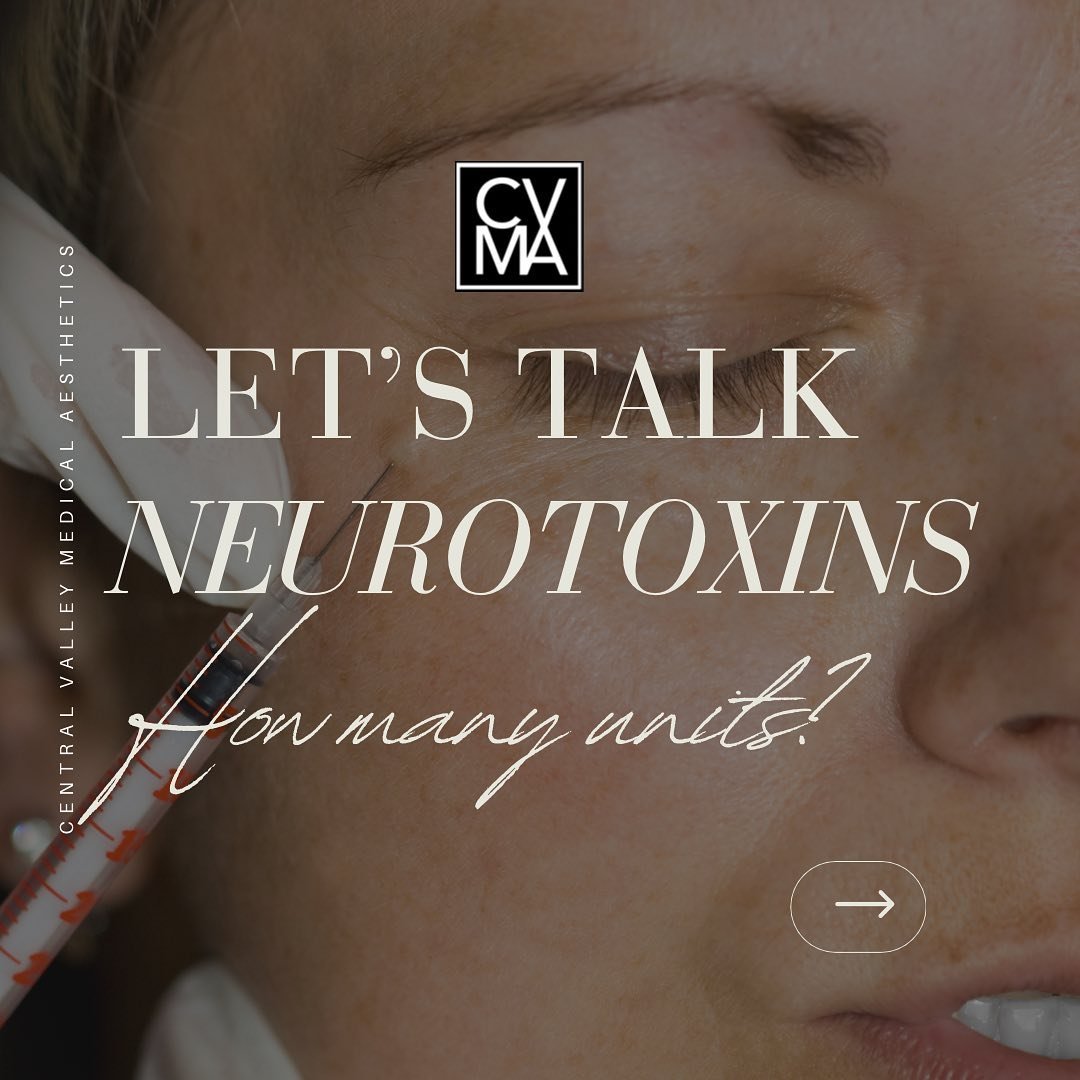 Neurotoxins are used in skin care to temporarily reduce frown lines, smile lines, crow&rsquo;s feet and forehead lines.
These treatment work by preventing the nerve signals that cause facial muscle contractions thereby relaxing the facial muscles tha