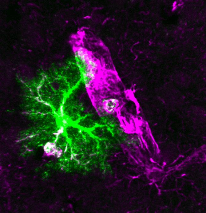 Microscopic view of a cell with green and pink fluorescent staining.