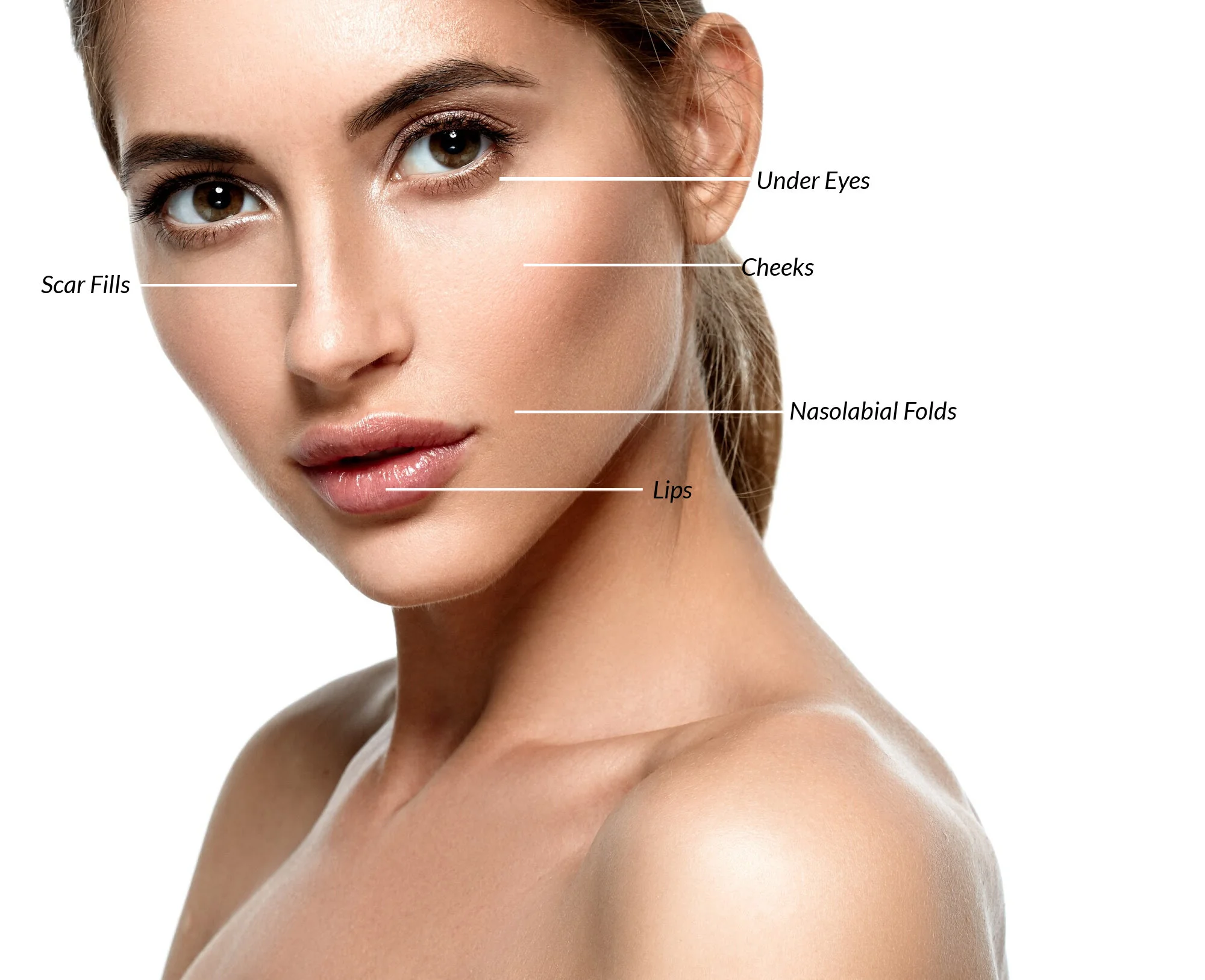Filler Treatment Areas-1 (1).jpg