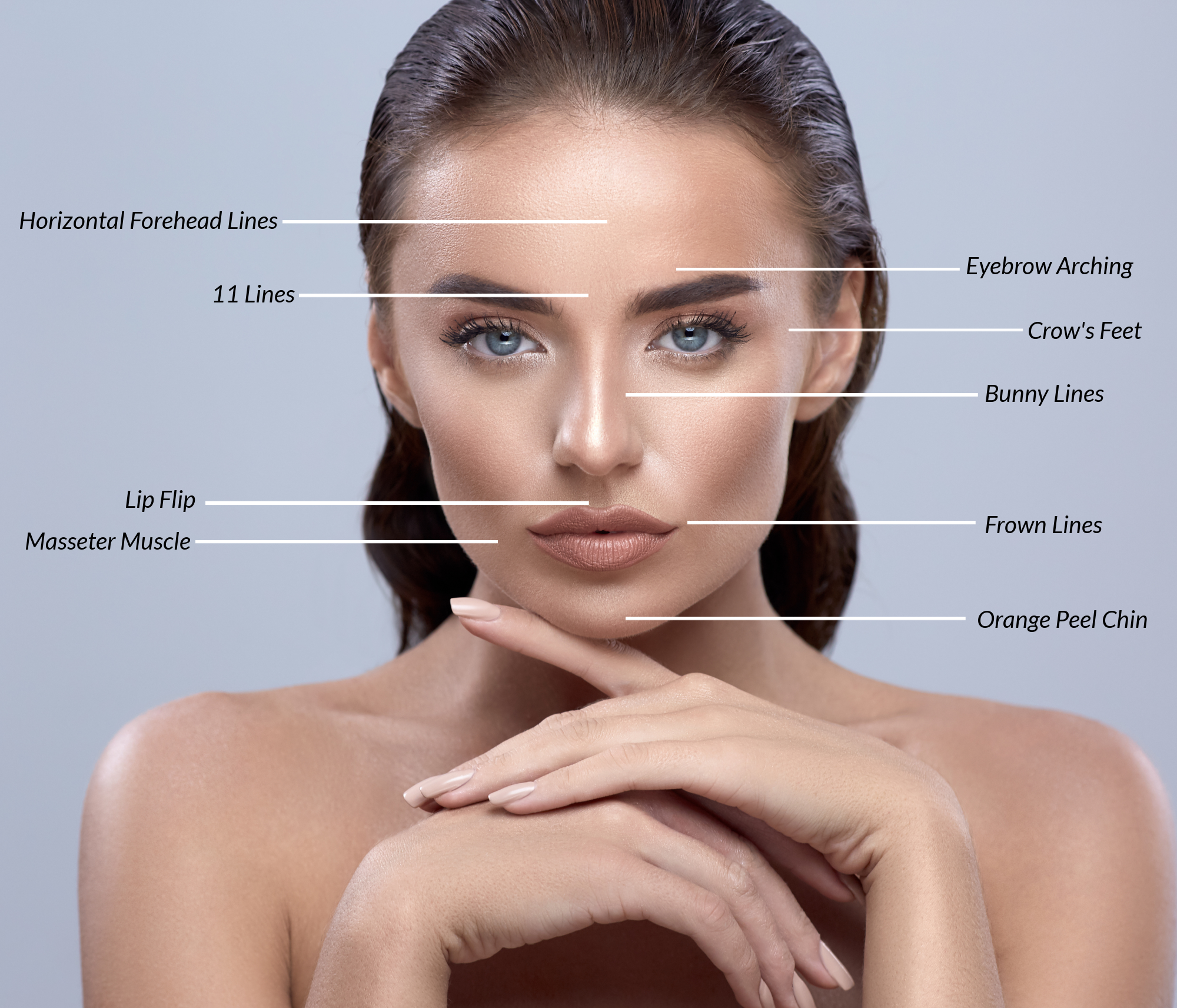 Botox Treatment Areas-1.png