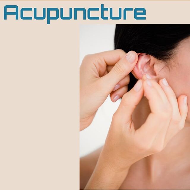 Auricular acupuncture involves the insertion of very fine filiform needles into meridians in the external part of your ear, which is a microsystem for the entire body. The needles have a round edge so they don&rsquo;t cut the skin. In auricular acuse