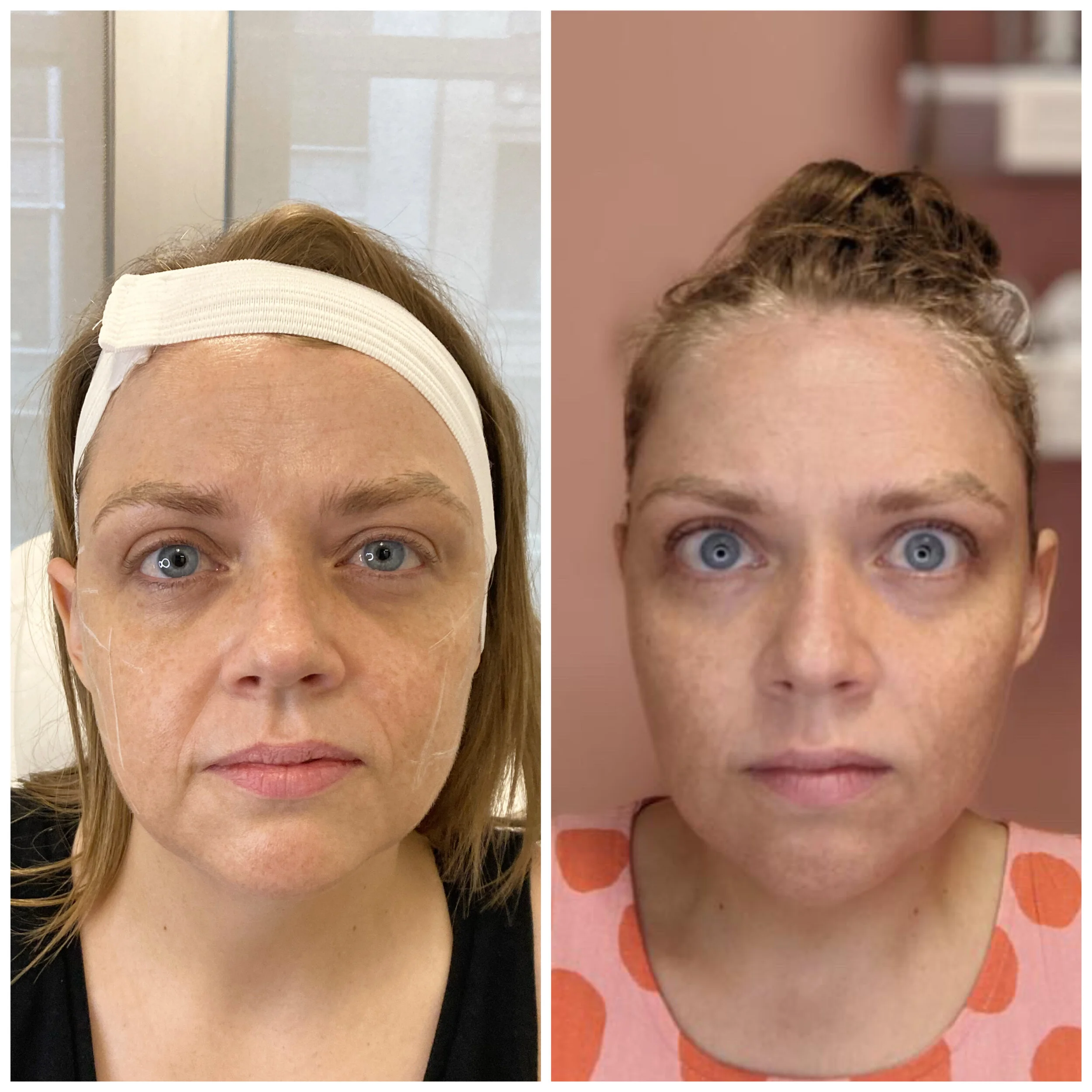 Before &amp; After gallery