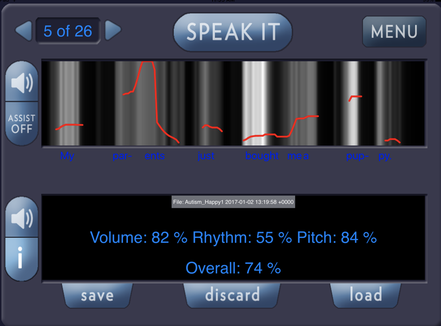 SpeechMatch: Match That Pitch