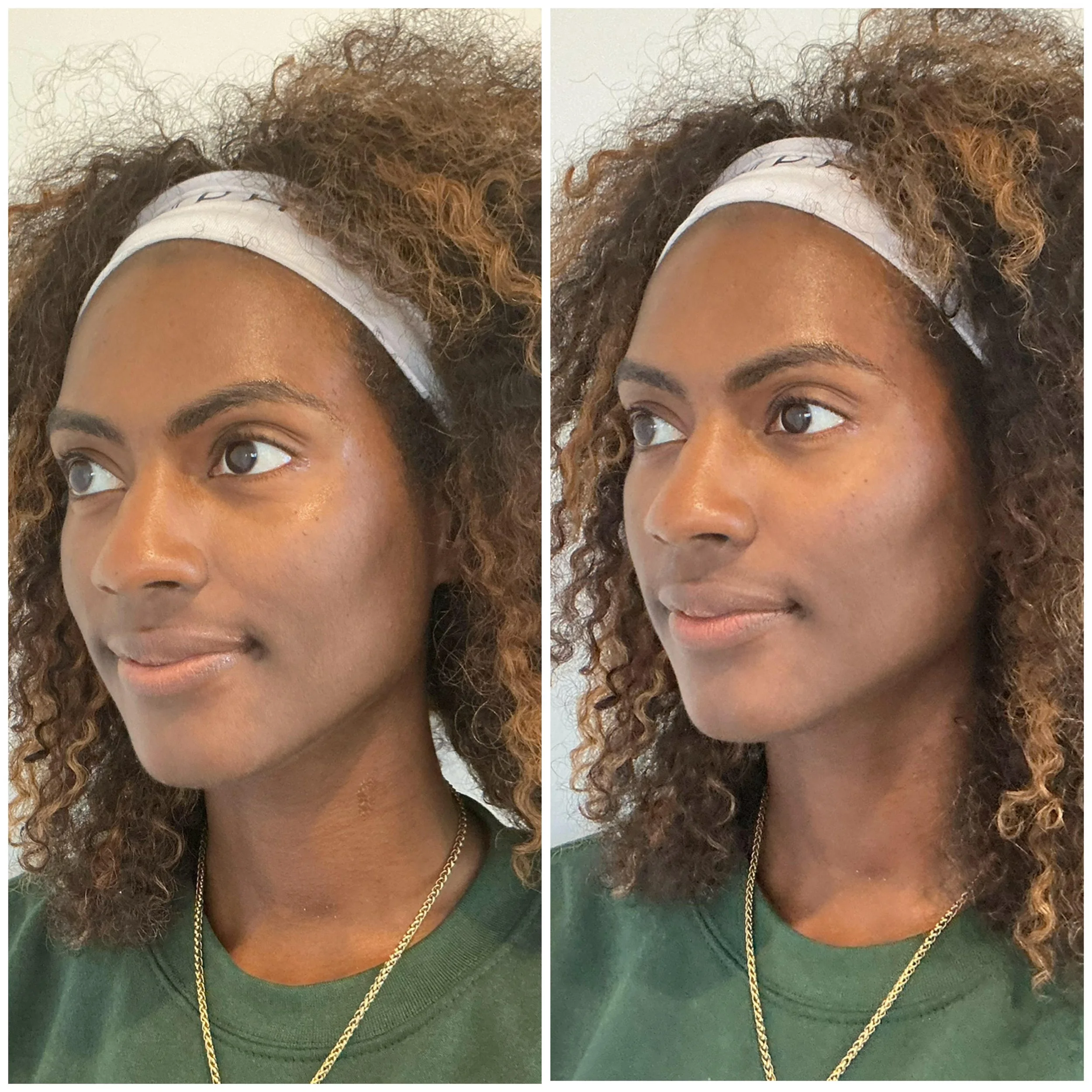 My Game-Changing Skincare Routine: The Treatment and Products That Transformed My Skin