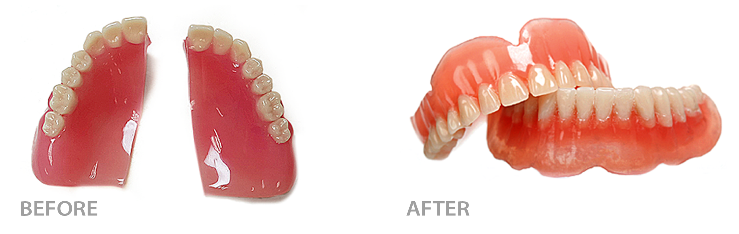  before image of denture set from above, flossy and broken in half beside after image of same dentures now fixed and in one piece  