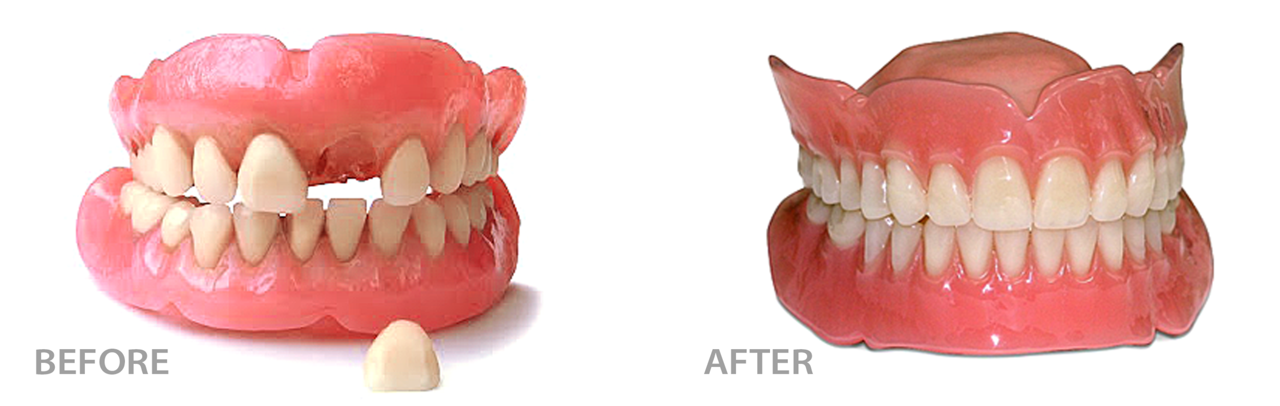  before image of denture set with tooth missing beside after image of same denture set with tooth fixed 