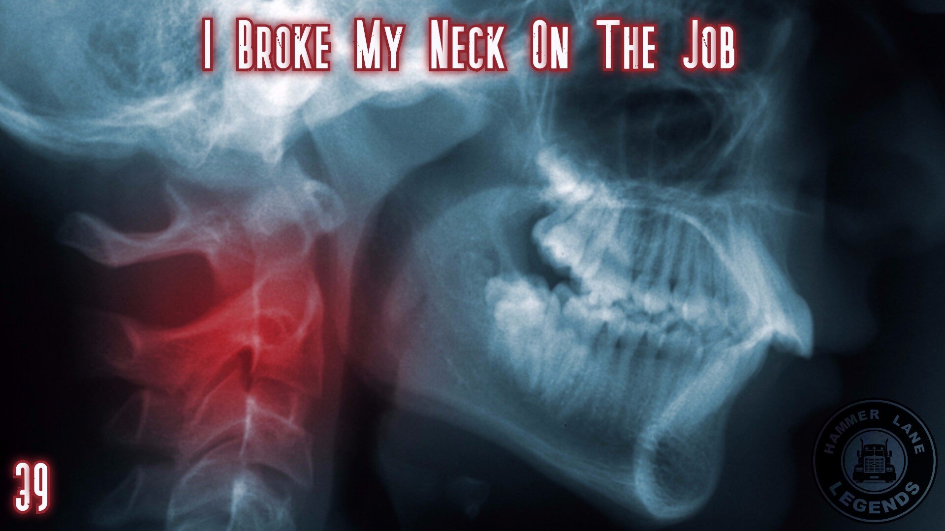 I BROKE MY NECK ON THE JOB.jpeg