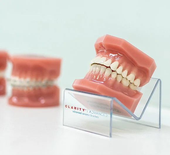 Orthodontic treatments.jpg