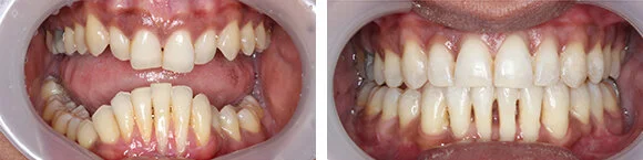 Before+&+After+Orthodontics3.jpg