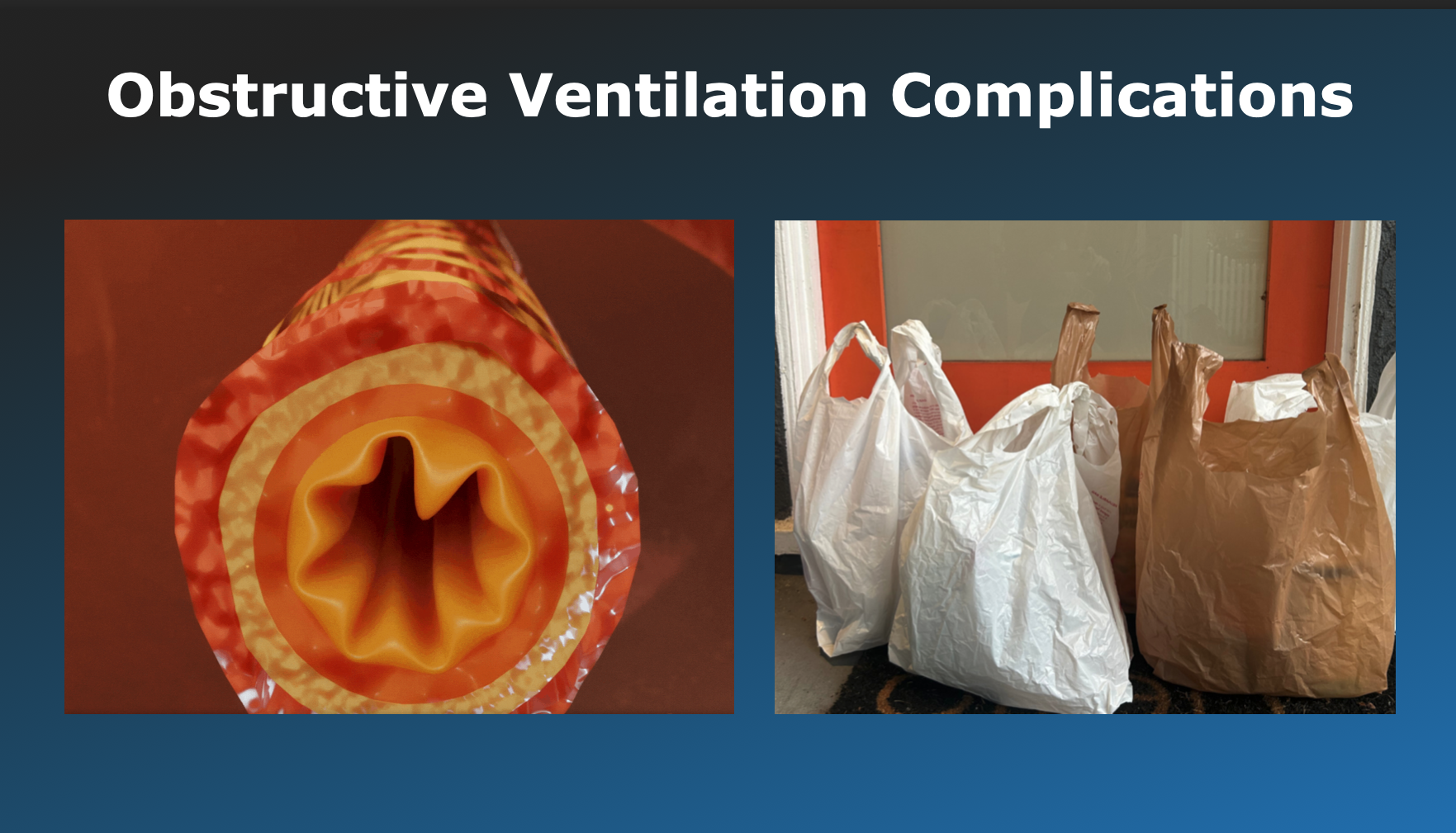 Two images illustrating obstructive ventilation complications. The first image shows a close-up of a soft plastic straw, possibly a rubber or silicone tube, with a narrow opening. The second image depicts several plastic shopping bags, some white and