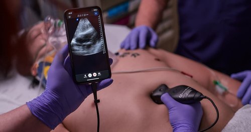 Medical professionals performing an ultrasound on a patient, holding a smartphone showing the ultrasound image, with their hands wearing purple gloves.