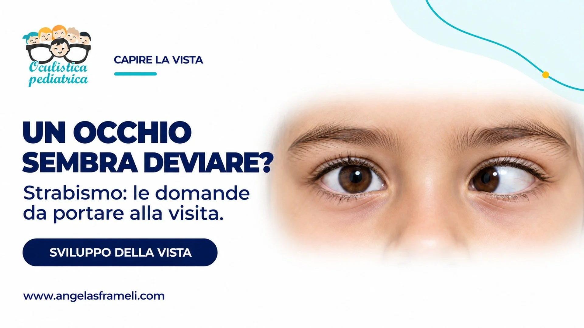 Immagine illustrativa di occhi con disallineamento.