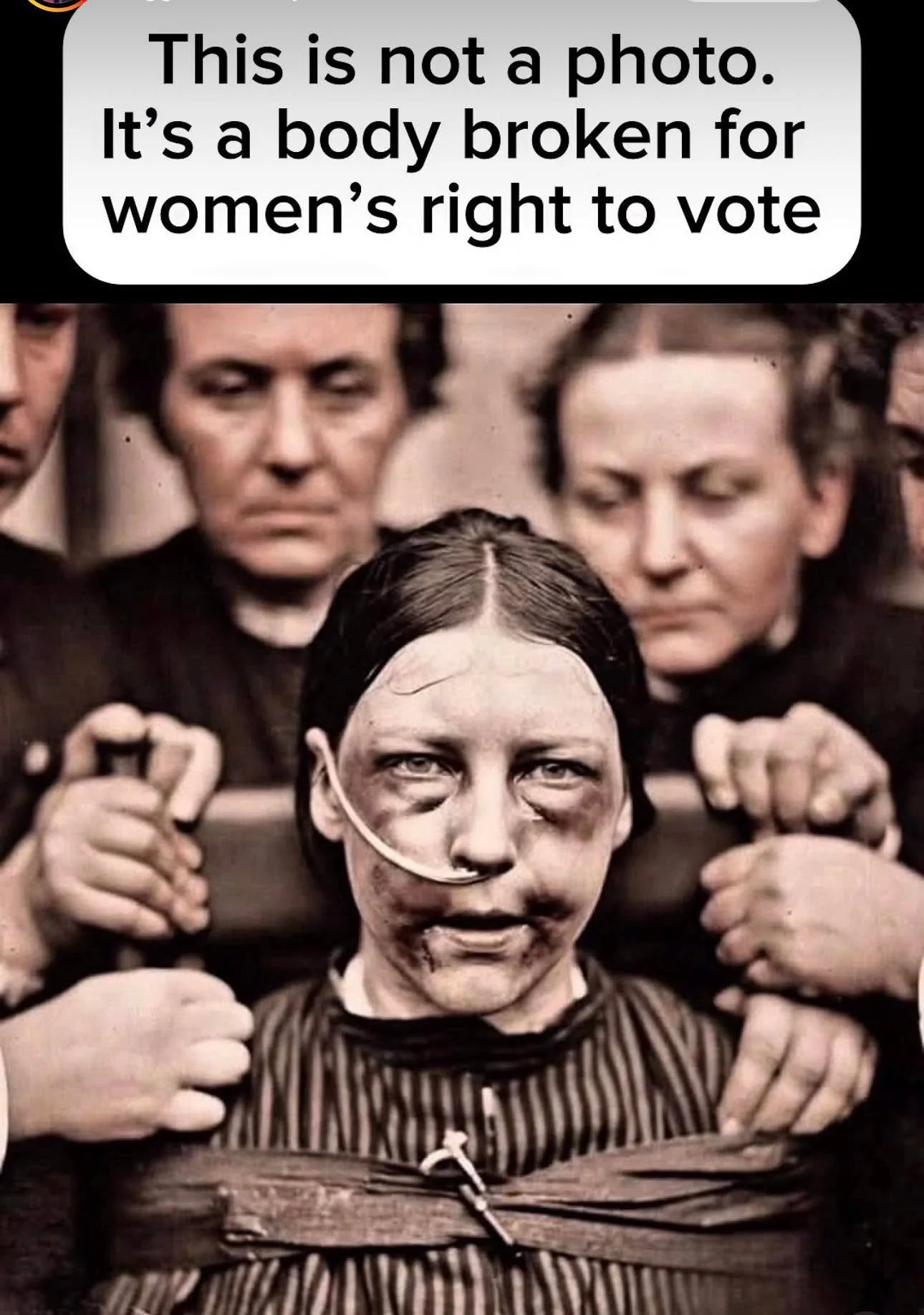 The audacity of anyone- and especialy woman- to say we don&rsquo;t need feminism. Alice Paul, one of many that fought for women&rsquo;s right to vote and suffered police brutality along the way.