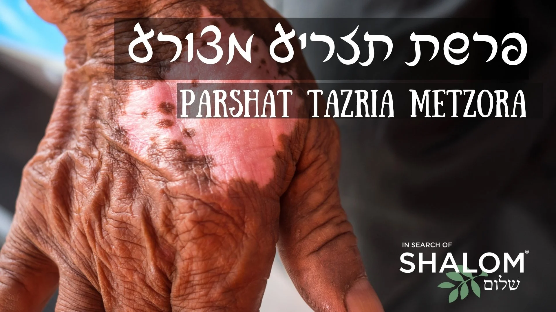 #26 — Parshat Tazria-Metzora