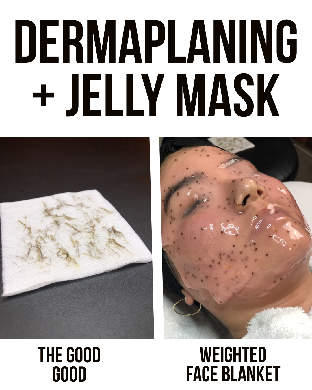 Dermaplaning + Hydrojelly Mask