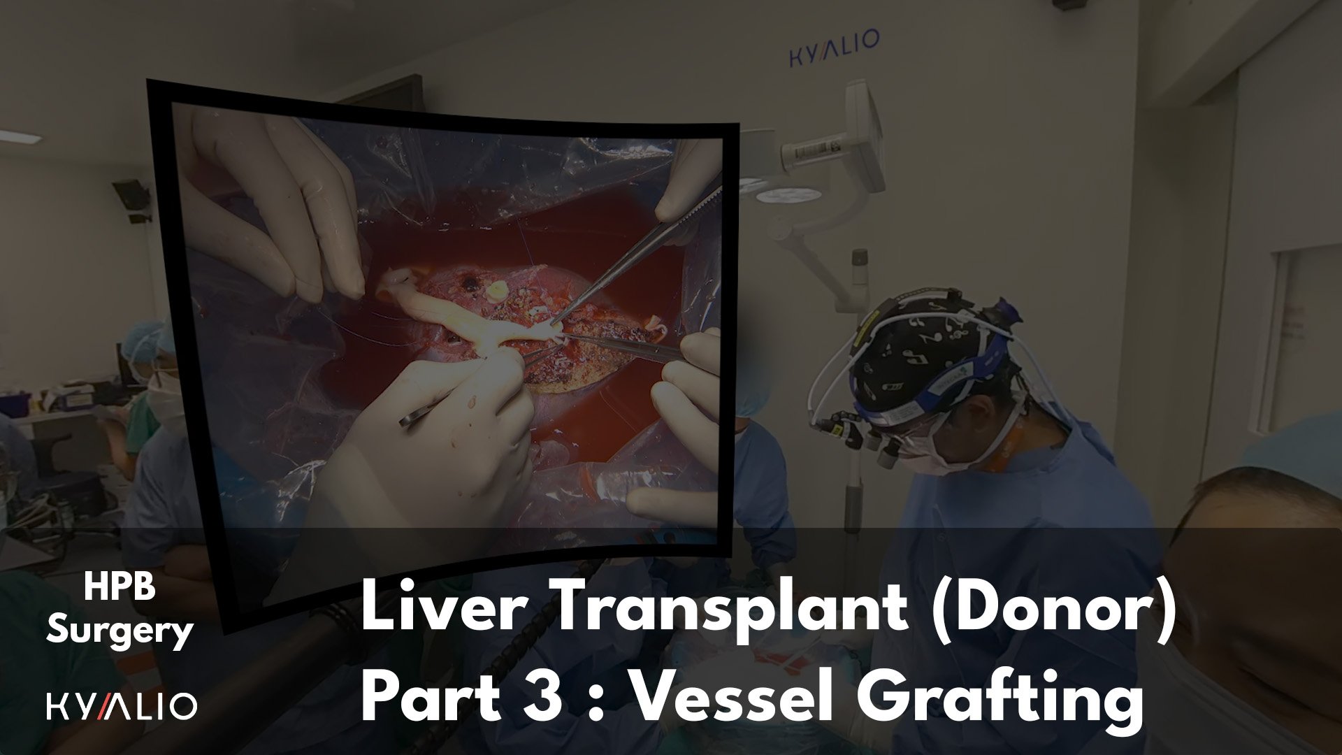 SG1_39_NUH_Shridhar_Liver_transplant_08062023_C_P3.jpg