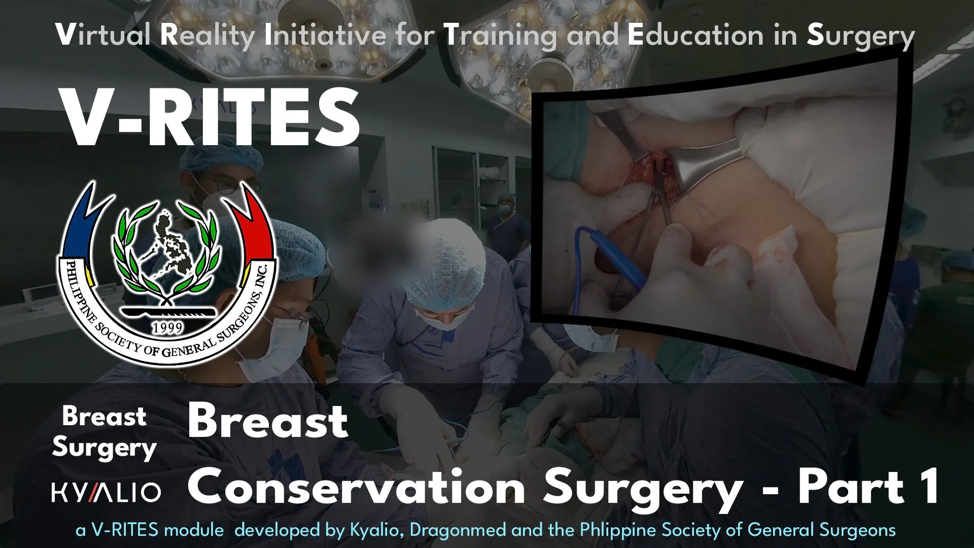 PH10_8_CUMC_RhoelDeLeon_Breast_Conservation_Surgery_23052024_Part_1_TN.jpg