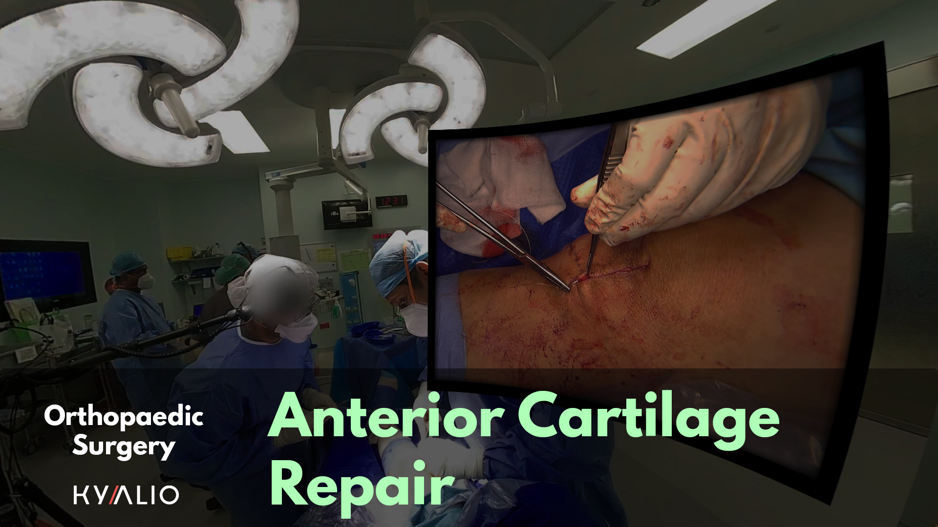 SKH_Hamid_Anterior_Cartilage_Repair_1920x1080.png