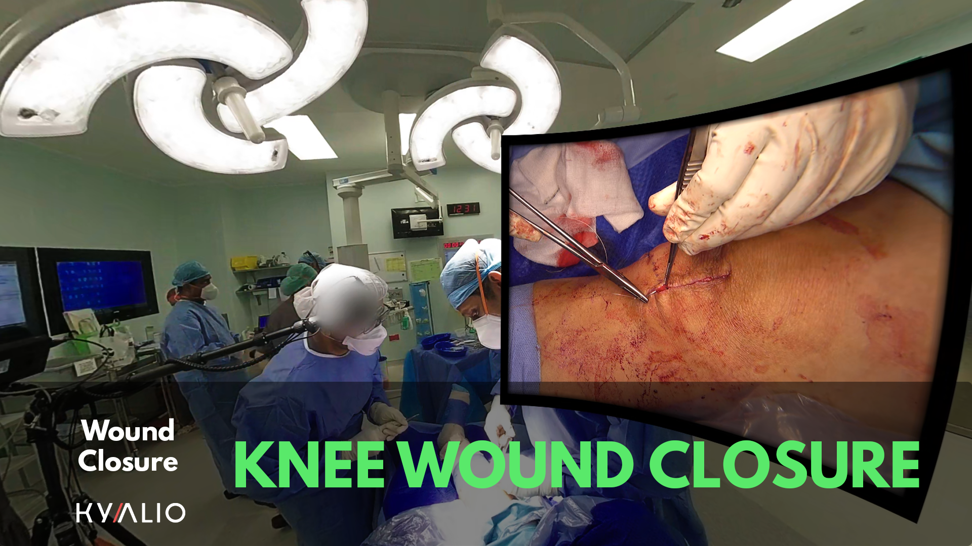 SKH_Hamid_Knee_Wound_Closure_1920x1080.png