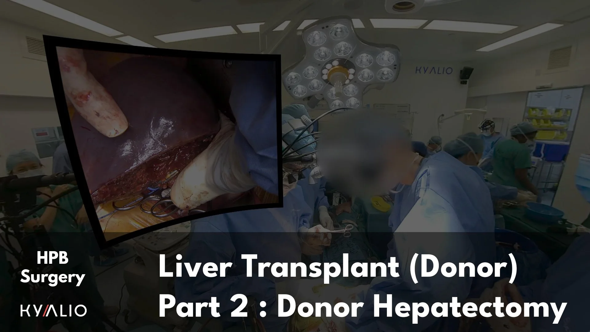 SG1_39_NUH_Shridhar_Liver_transplant_08062023_C_P2.jpg
