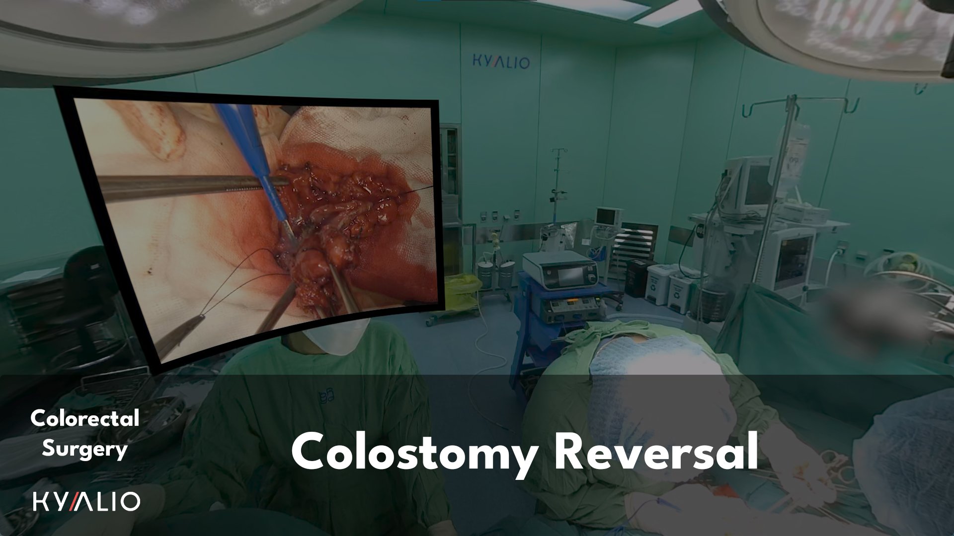 VN1_68_HCM-UMC_Sang_Colostomy_Reversal_30082022_TN.jpg