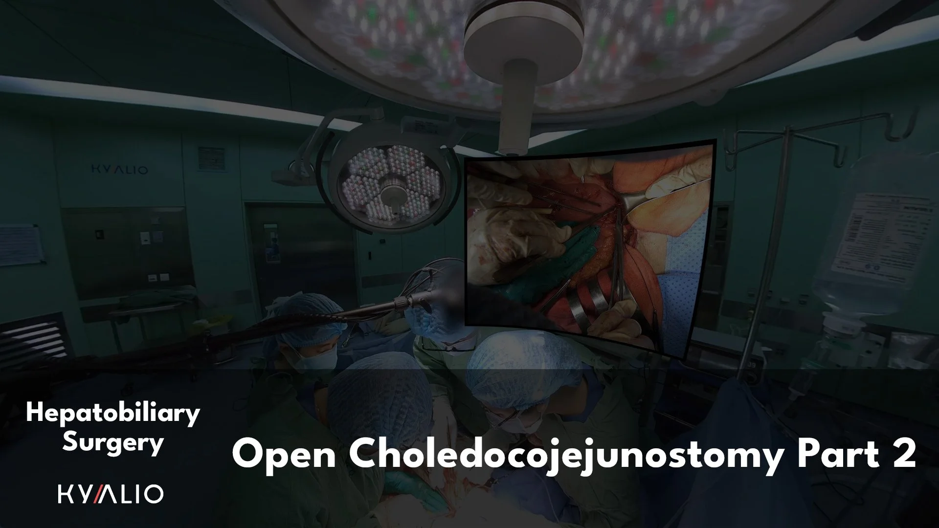 VN1_72_HCM-UMC_Sang_Open_Choledochojejunosctomy_30082022_P2_TN.jpg.jpg