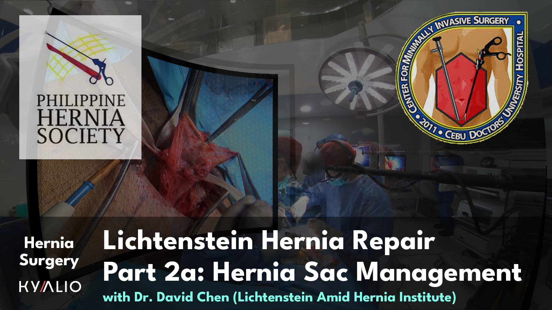 PH10_21_CDUH_DavidChen_Lichtenstein Hernia Repair_24092024_P2a_TN.jpg