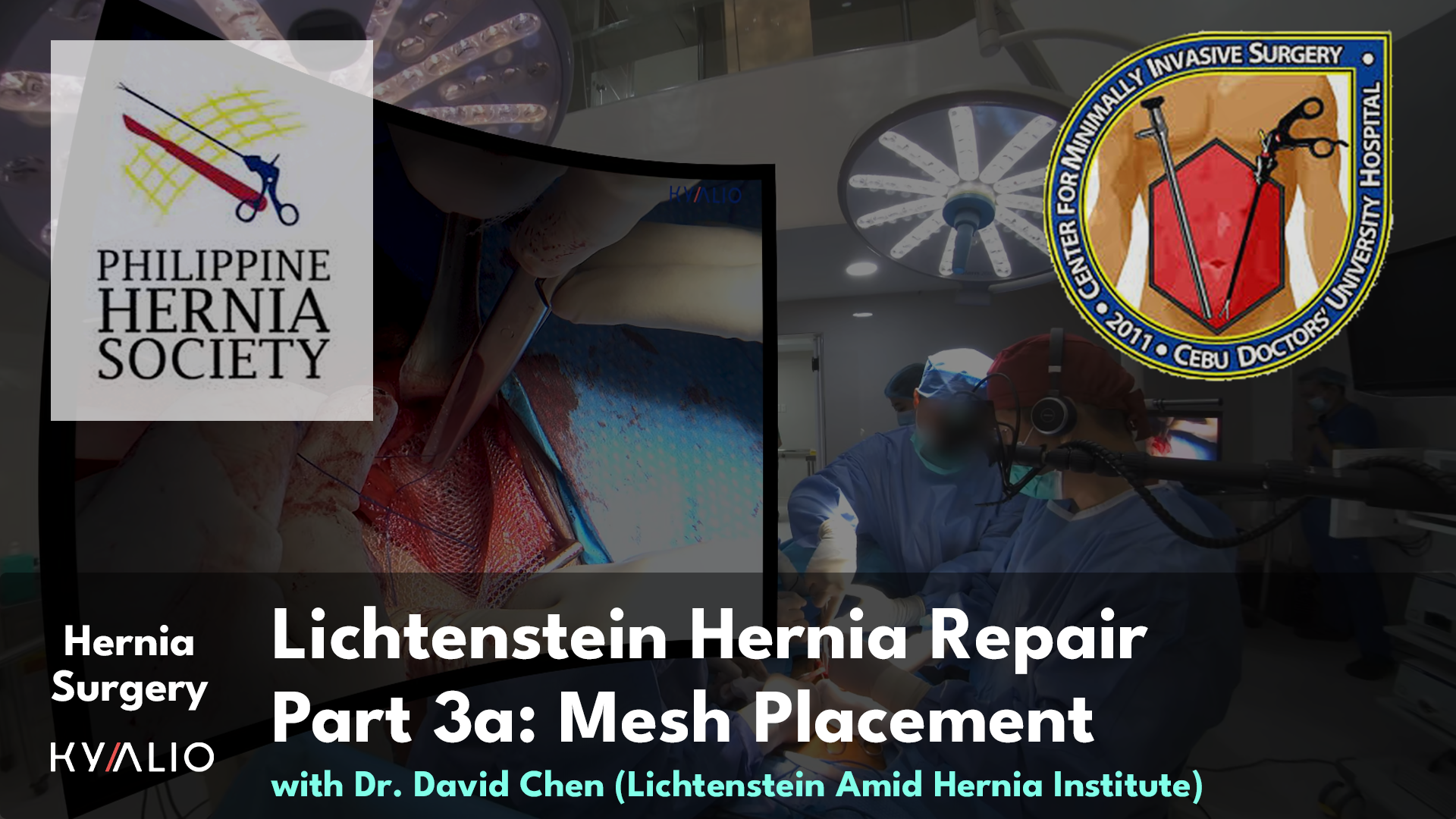 PH10_21_CDUH_DavidChen_Lichtenstein Hernia Repair_24092024_P3a_TN.jpg