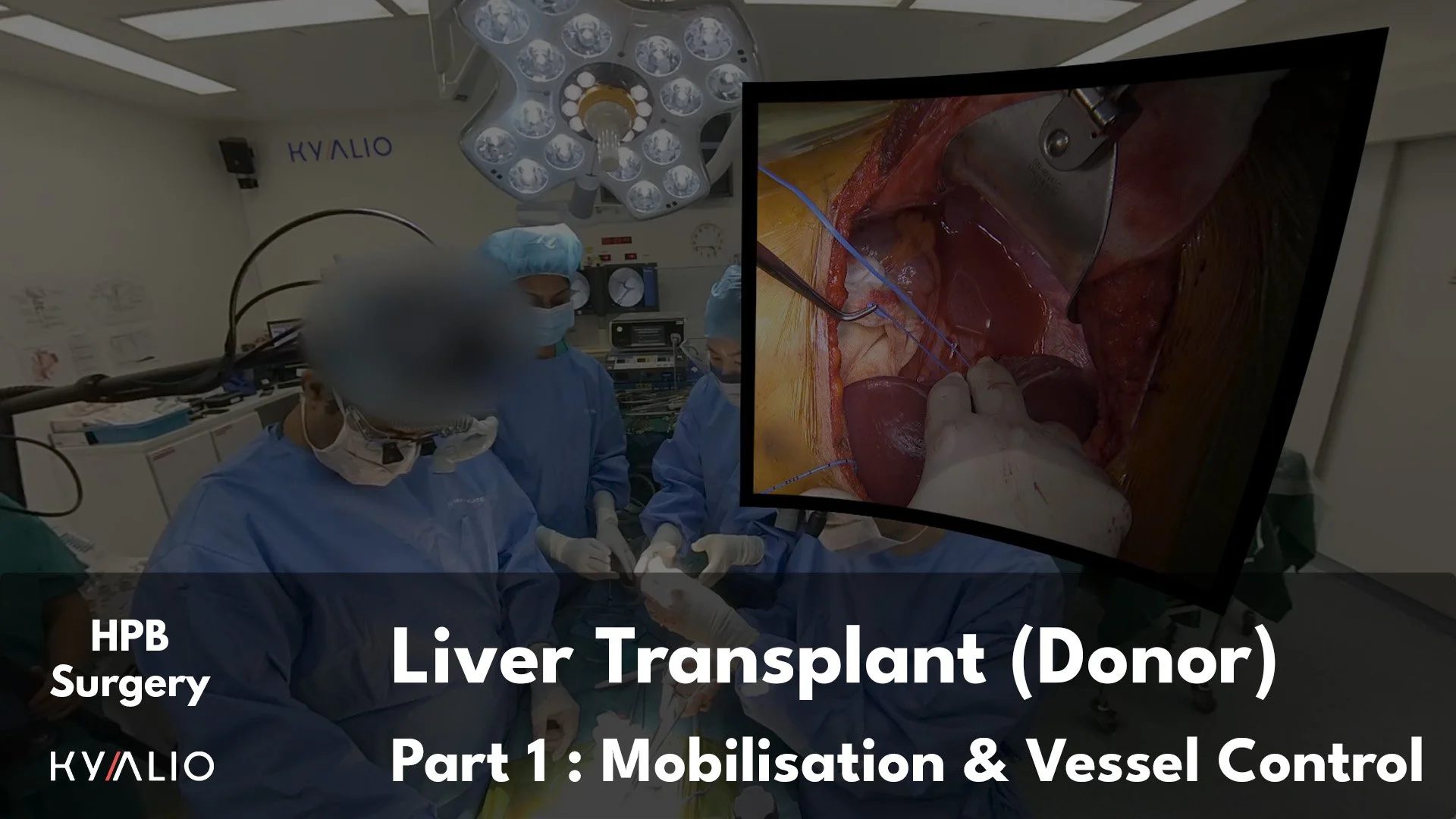 SG1_39_NUH_Shridhar_Liver_transplant_08062023_C_P1.jpg