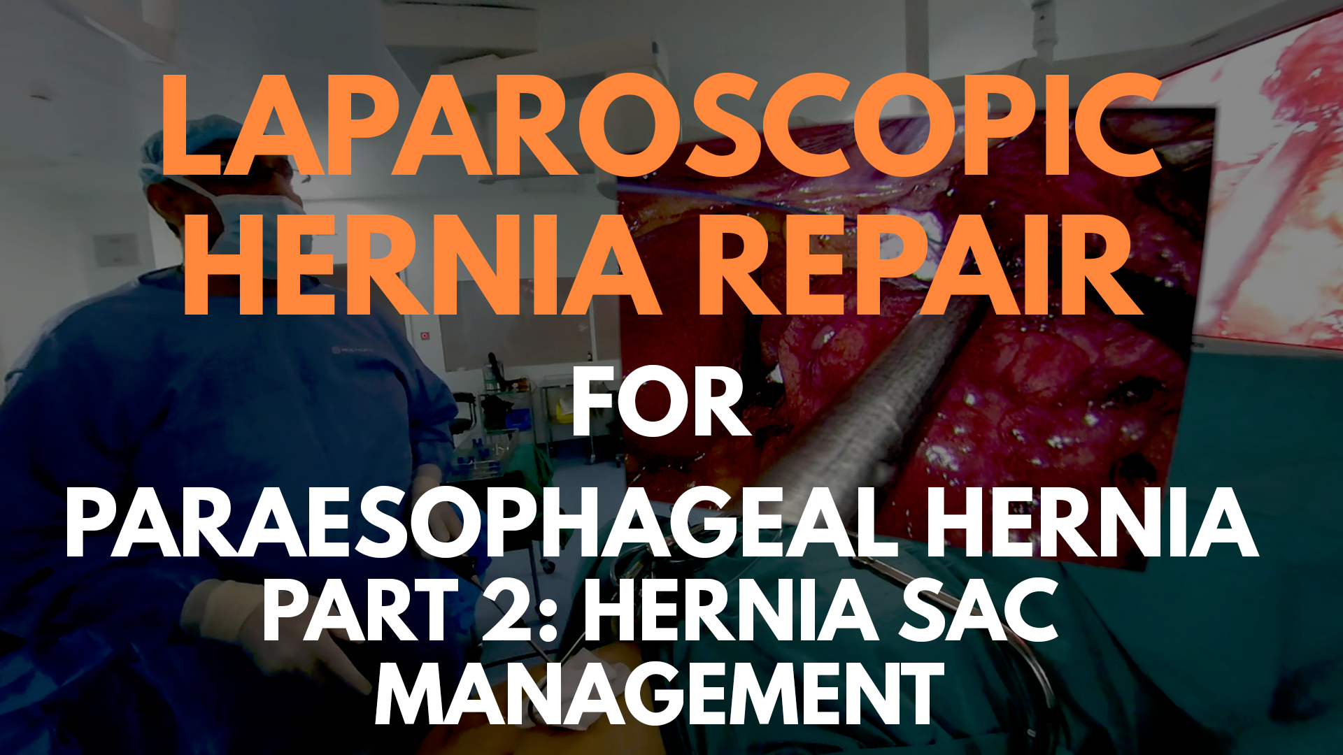 Laparoscopic Hernia Repair for Paraesophageal Hernia_part 2.png