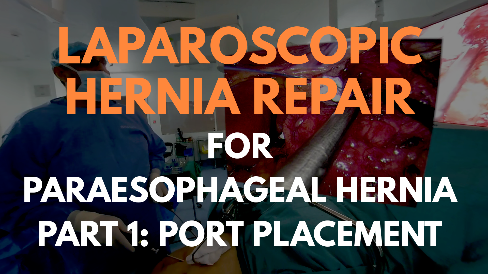 Laparoscopic Hernia Repair for Paraesophageal Hernia_part 1.png