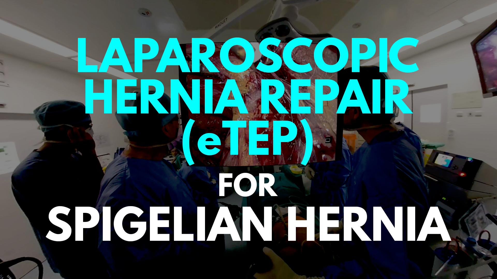 eTEP for spigelian hernia.png