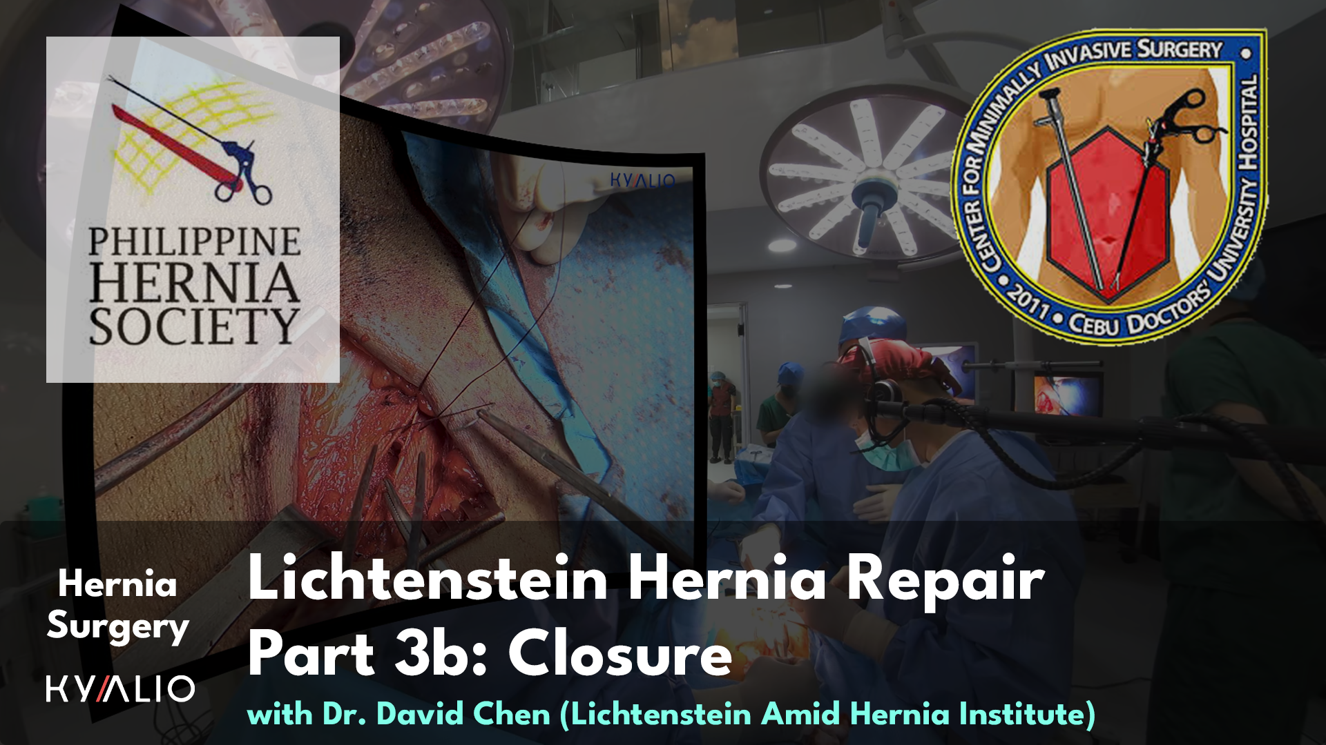PH10_21_CDUH_DavidChen_Lichtenstein Hernia Repair_24092024_P3b_TN.jpg