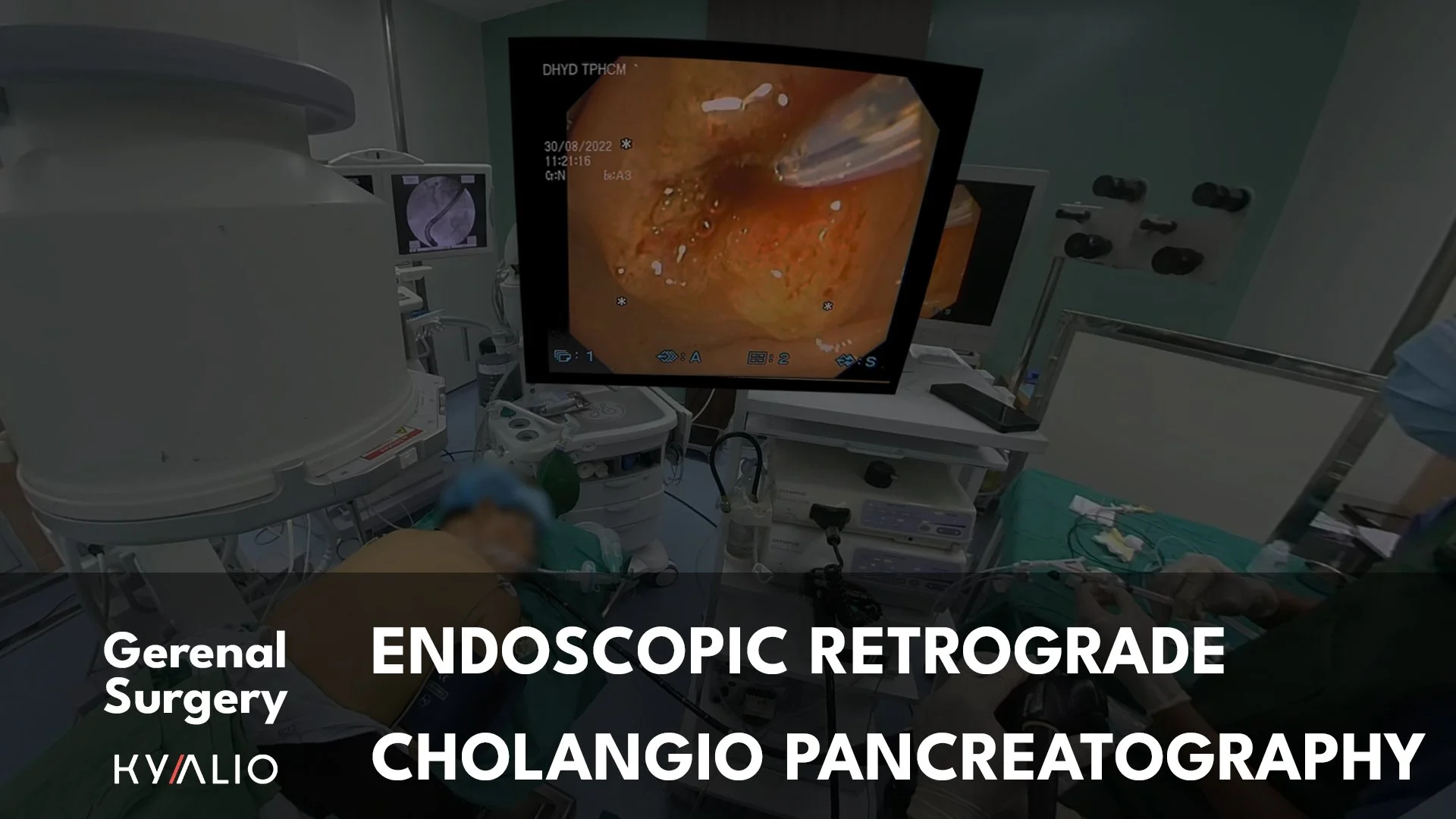VN1_69_HCM-UMC_Tran Huy_ERCP_30082022_.jpg