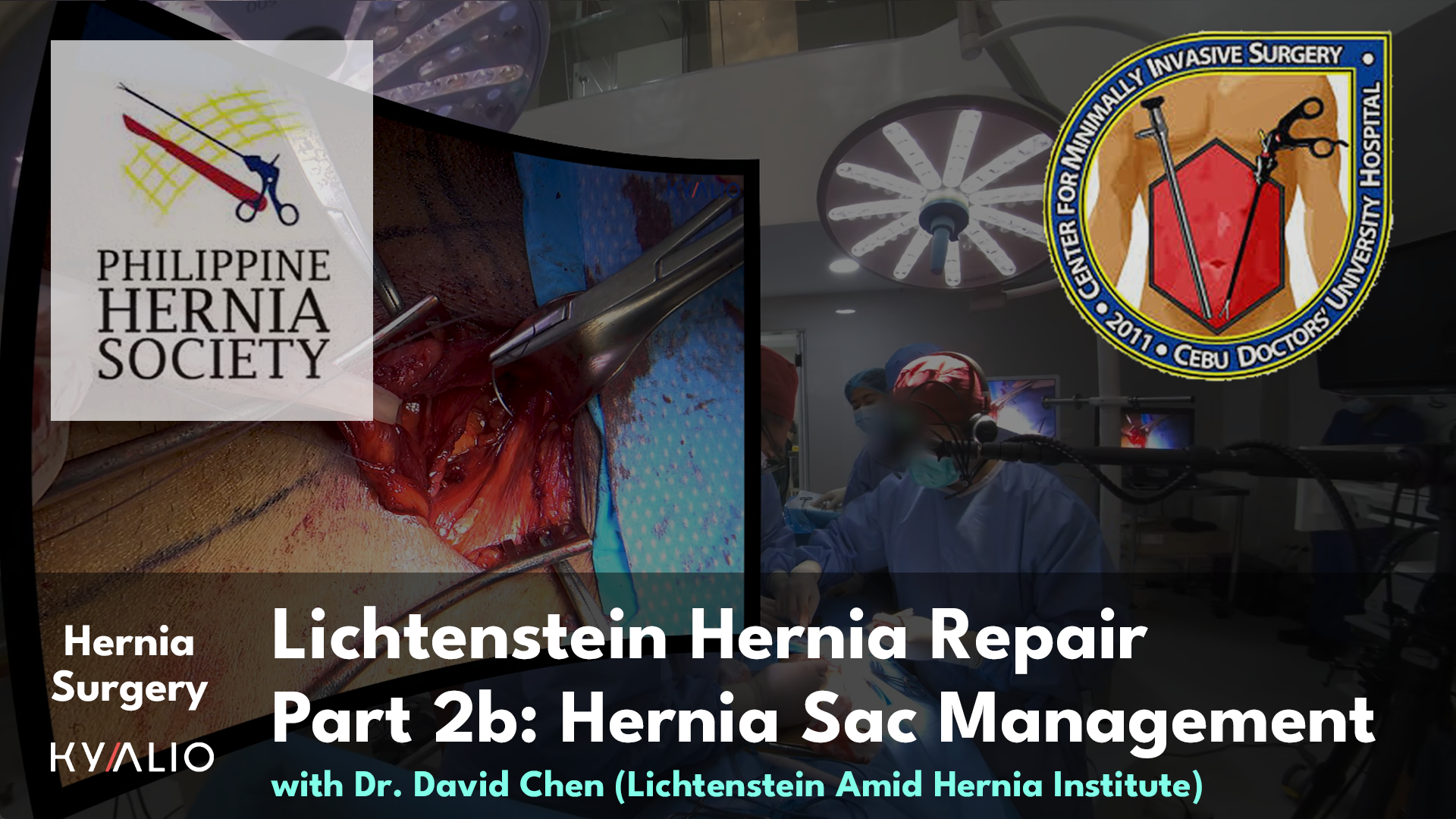 PH10_21_CDUH_DavidChen_Lichtenstein Hernia Repair_24092024_P2b_TN.jpg