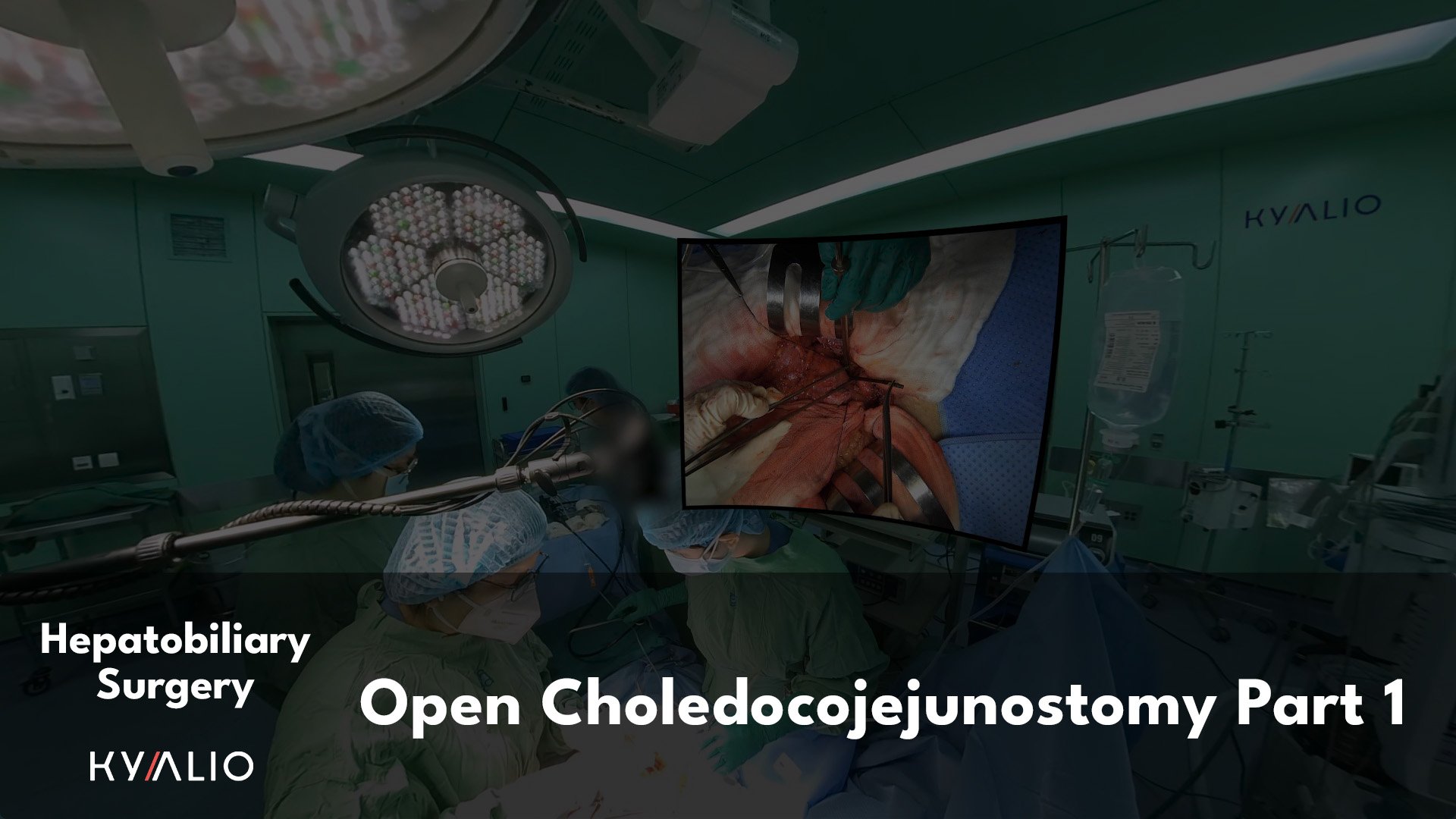 VN1_72_HCM-UMC_Sang_Open_Choledochojejunosctomy_30082022_P1_TN.jpg