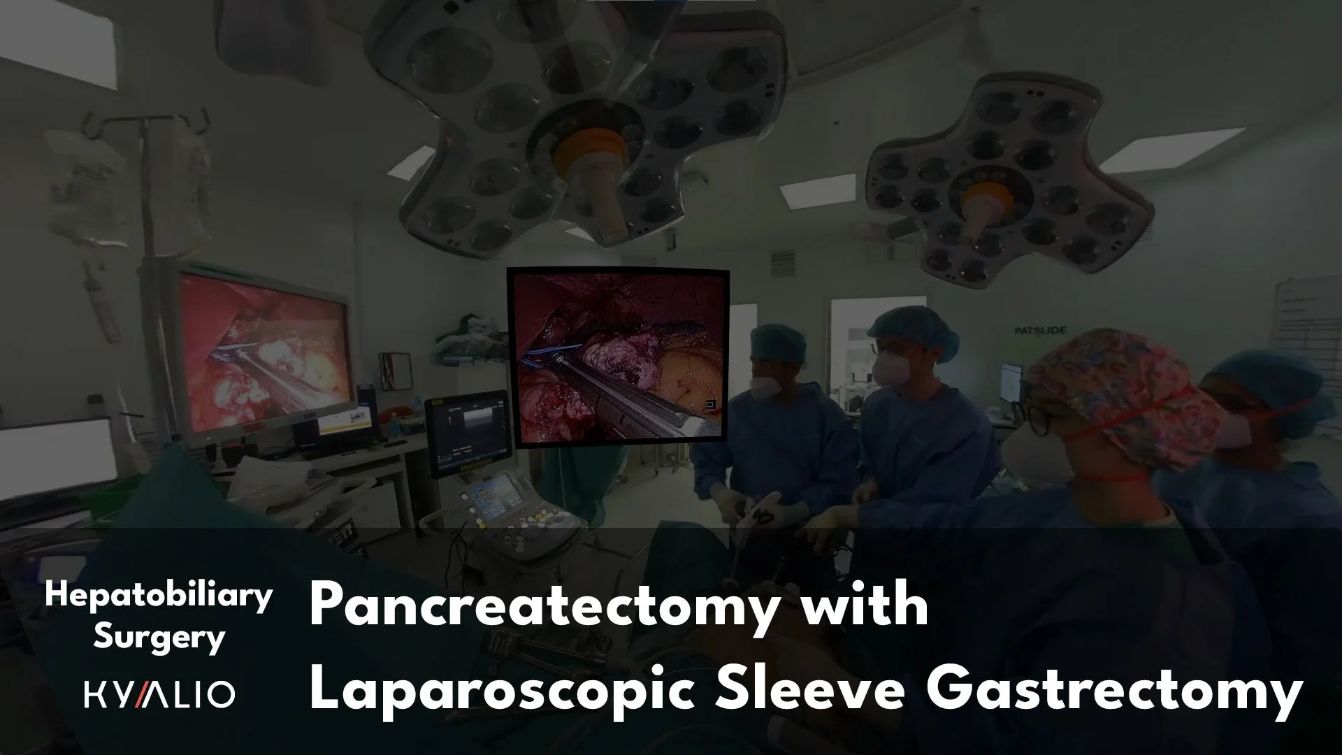 SG1_48_NUH_Shridhar_Pancreatectomy_with_LSG_07022022_C.jpg