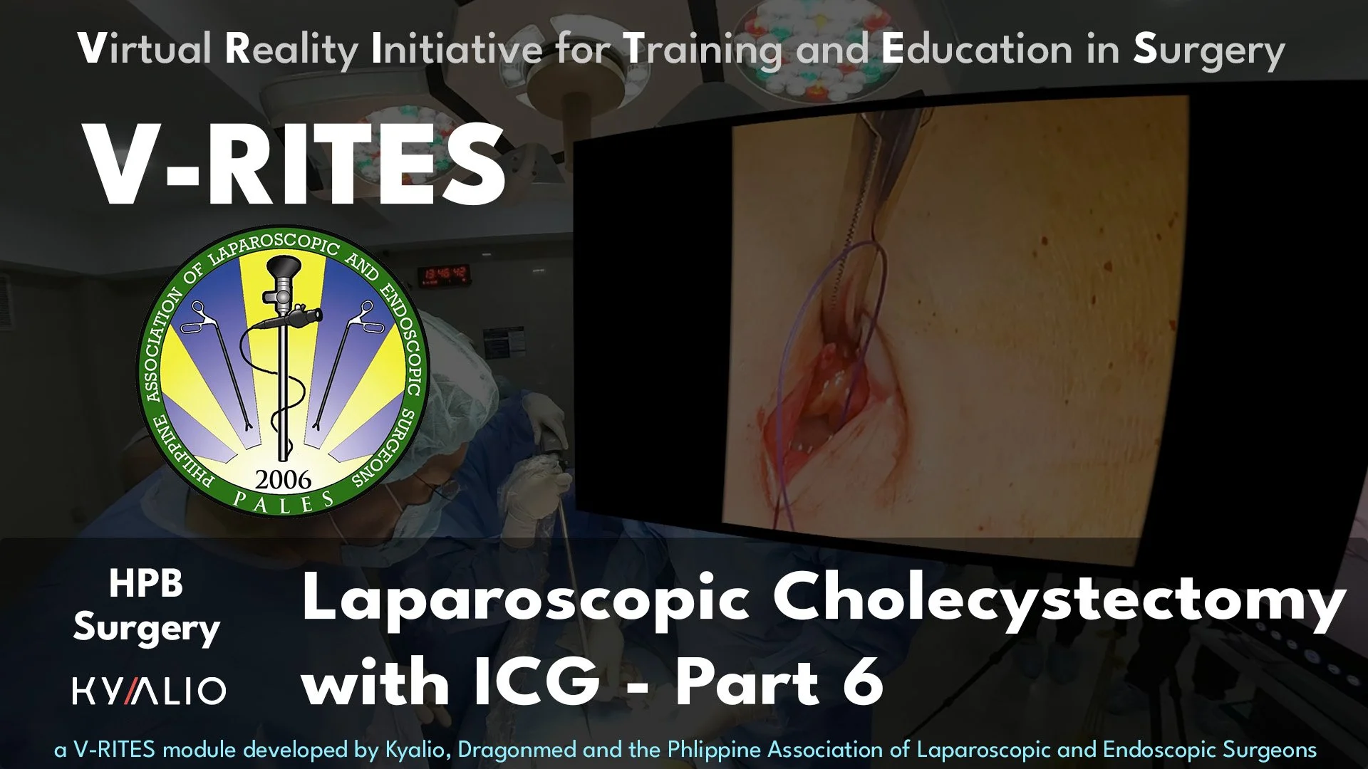 PH1_8_FEU_Raymund_Lap_Cholecystectomy_with_ICG_08112023_P6_PALES.jpg