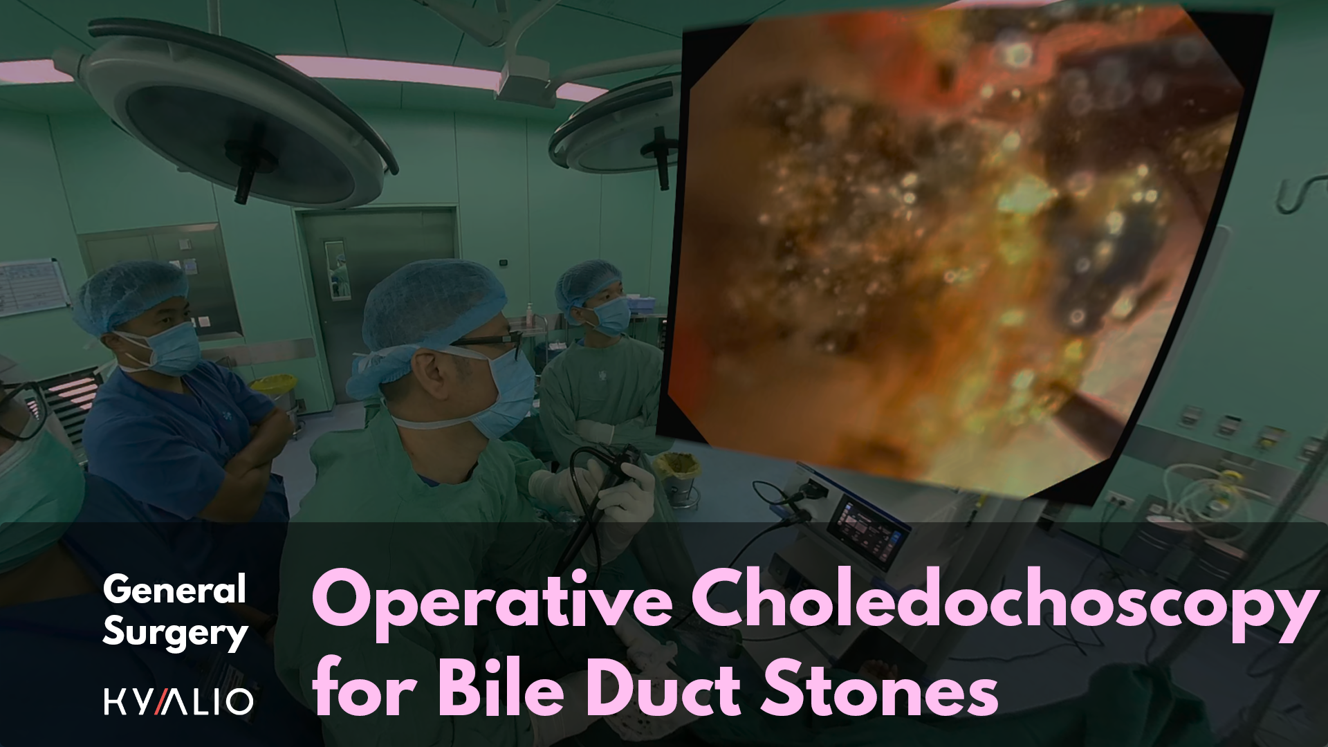 VN1_1_HCM-UMC_Pham Minh Hai_Choledochoscopy.png