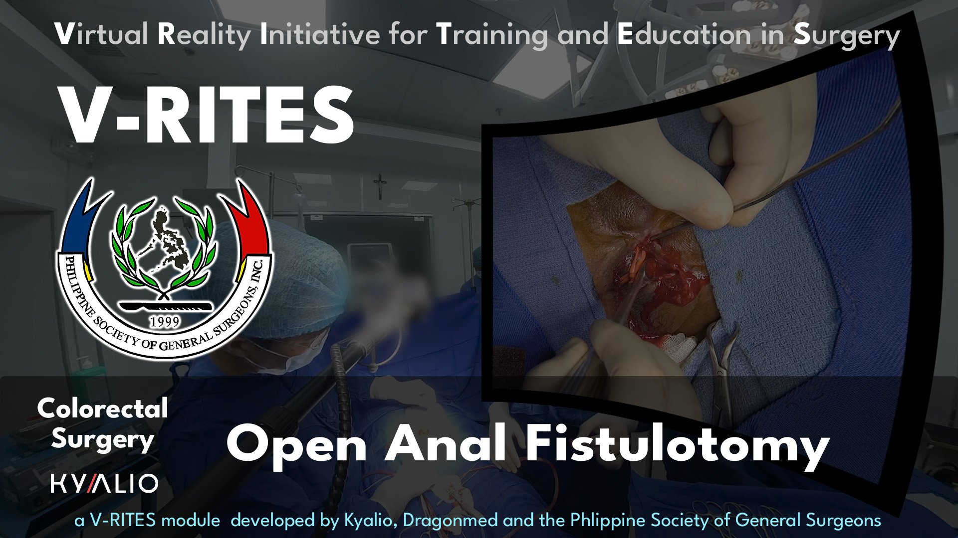 PH5_1_MTCMC_Azores_Open_Anal_Fistulotomy_03032024_PSGS.jpg
