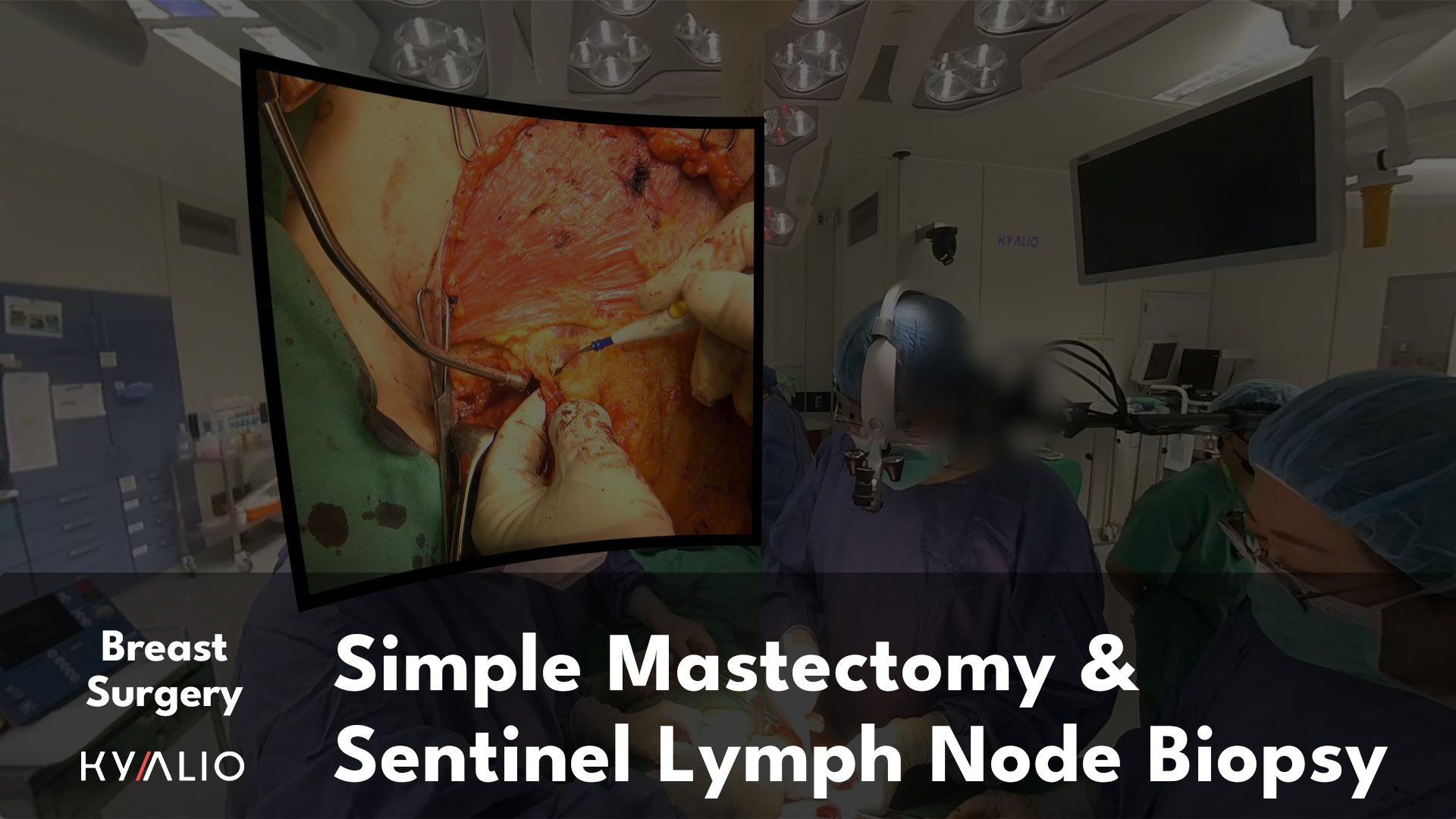 TW1_102_NCKU_Lee_Kuo_Ting_Simple_Mastectomy_and_Sentinel_Lymph_Node_Biopsy_20042023_TN.jpg