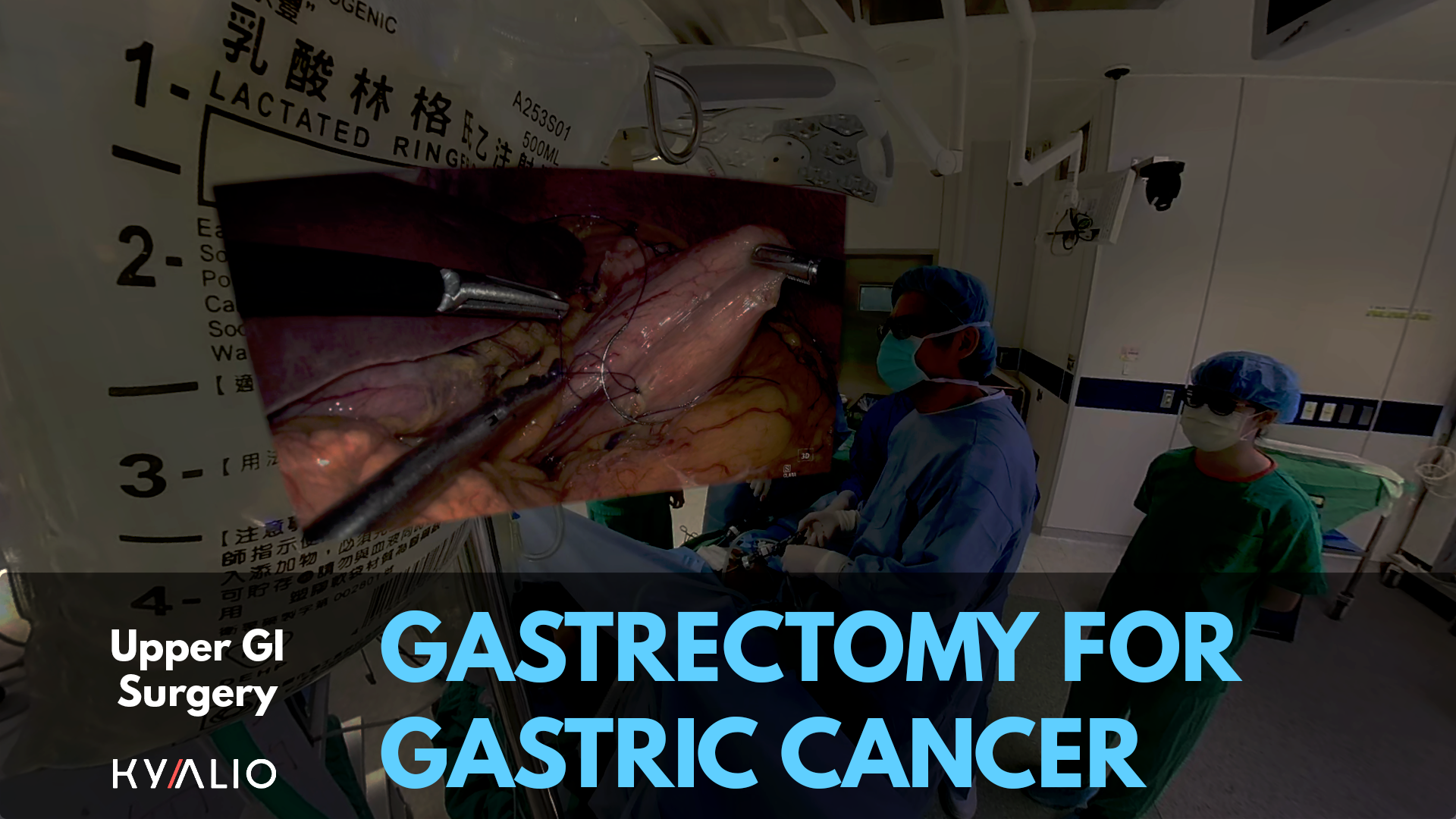 Gastrectomy_TN.png
