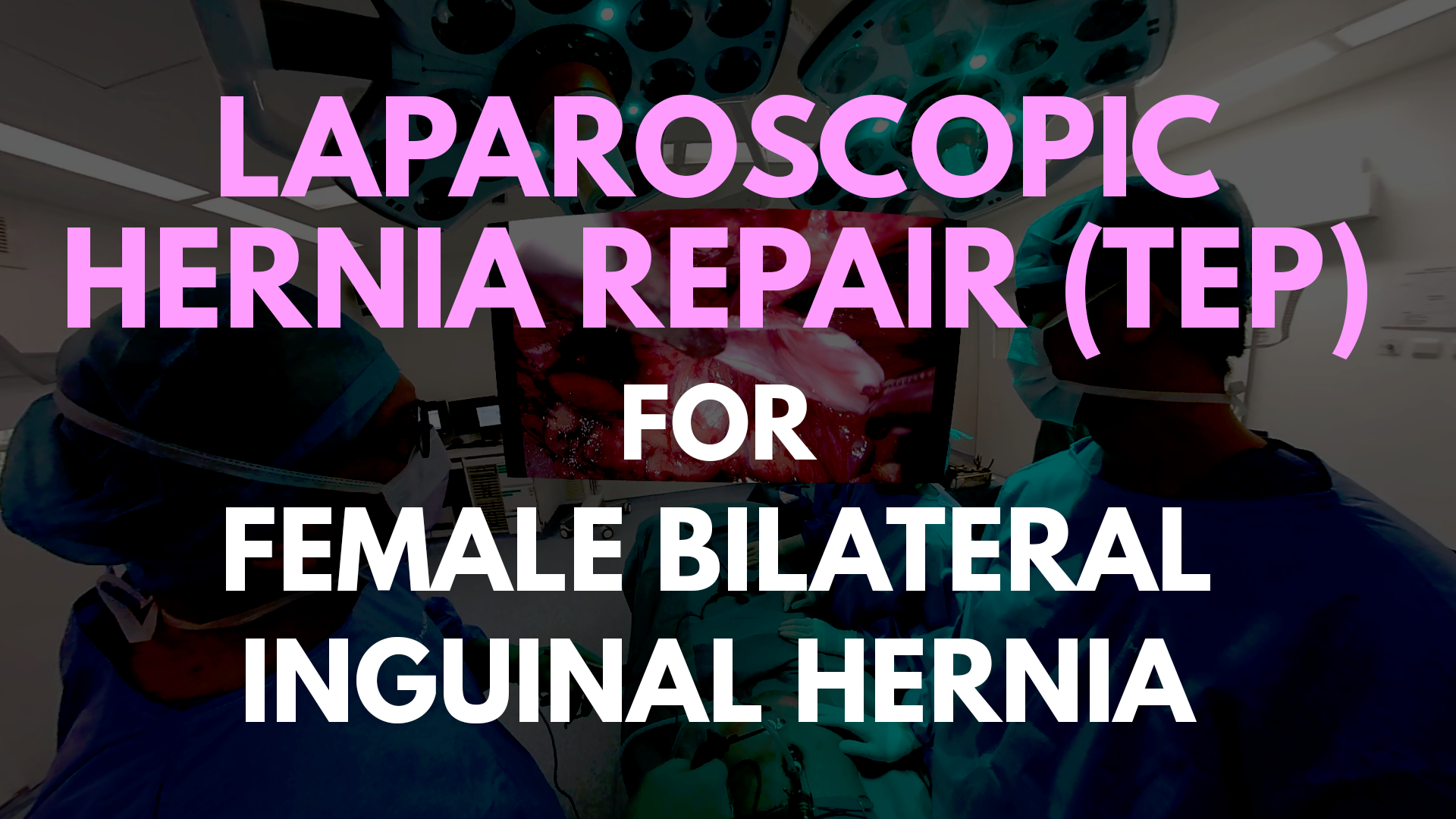 TEP for female bilateral inguinal hernia.png
